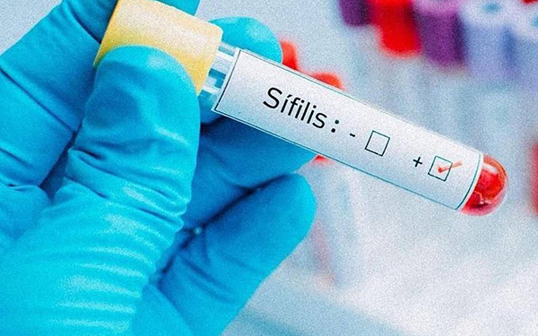 La cantidad de casos de sífilis aumentó 71% en 2025